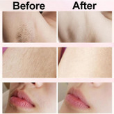 ماشین اصلاح تخصصی بیکینی درماول (Dermavel) مدل 2.0؛ تحولی در زیبایی و مراقبت شخصی (نسخه 2025)