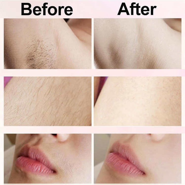 ماشین اصلاح تخصصی بیکینی درماول (Dermavel) مدل 2.0؛ تحولی در زیبایی و مراقبت شخصی (نسخه 2025)